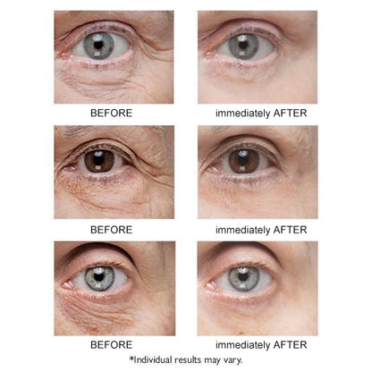 🎁Last Day 49% OFF🎁Instant Eye Temporary Eye Tightener