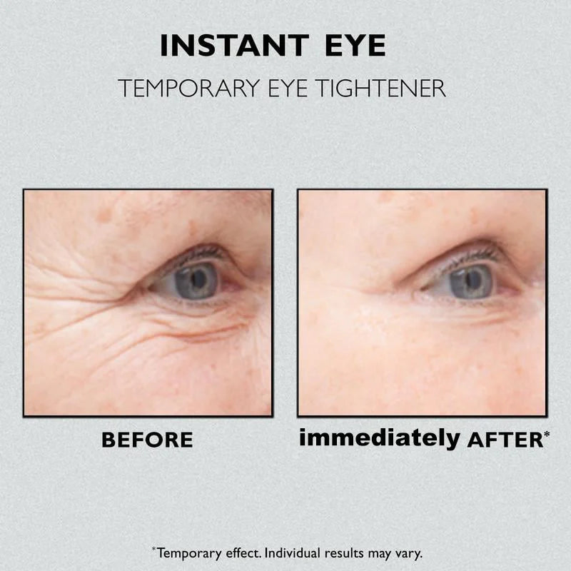 🎁Last Day 49% OFF🎁Instant Eye Temporary Eye Tightener